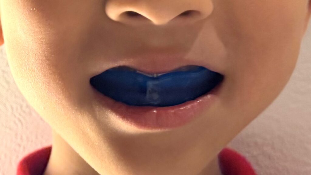 プレオルソについて