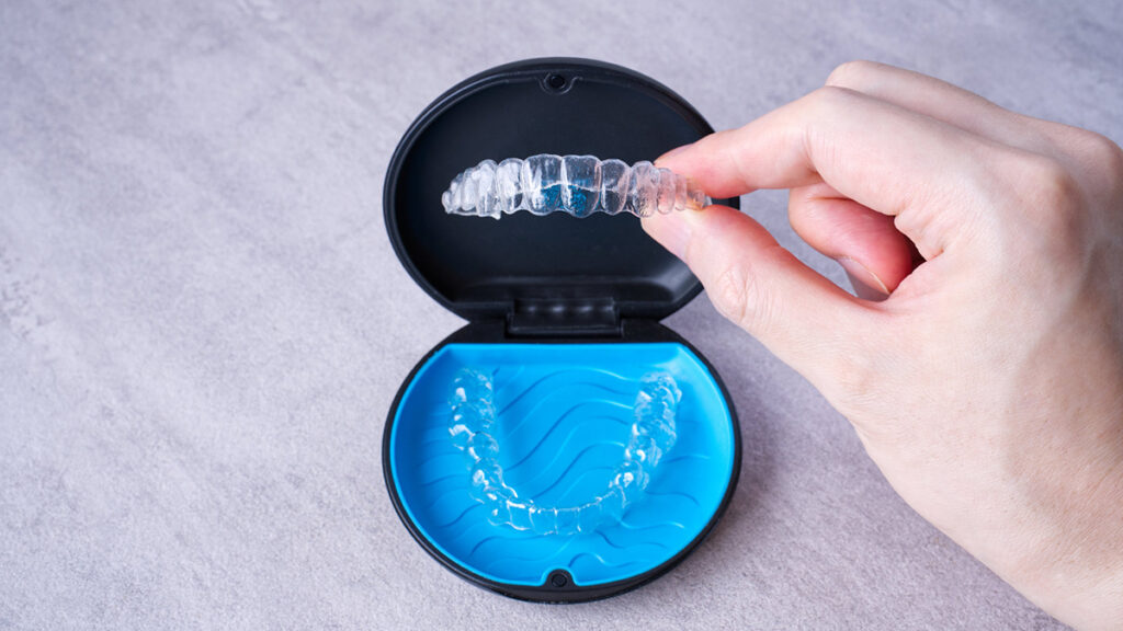 インビザライン・ファースト